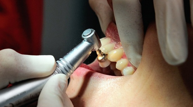 Access to oral care and dental health is a human right, says CHR